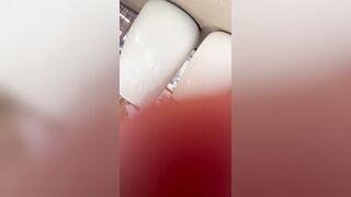 ㅈㅉ 이것저것2 korean porn ipcam (10)