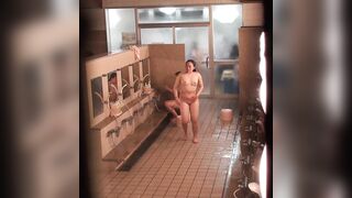 【確実開き・見え限定】ＣＫアワビ自画１０本セット。。。② voyeur jp 180526